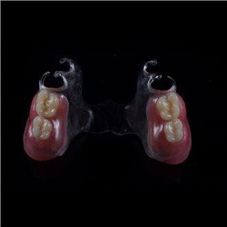 Denture parzjali akriliċi li jistgħu jitneħħew