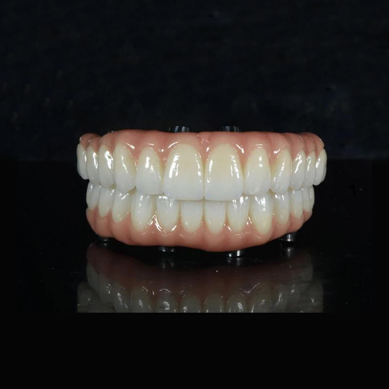 ALL-ON -X PONT ZIRCONIA