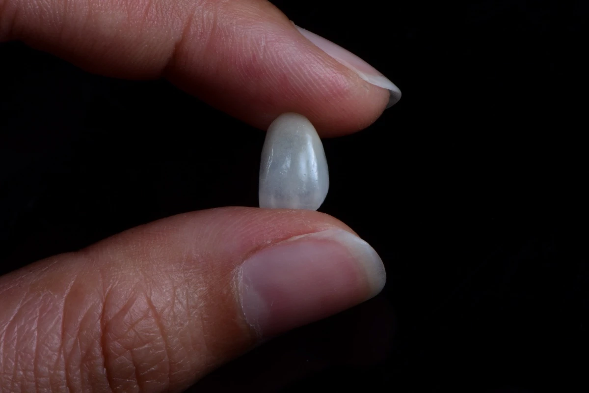 Layered E.max Veneers Layered E.max Veneers