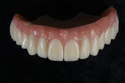 Kuruna Temporanja tar-Reżina Akrilika