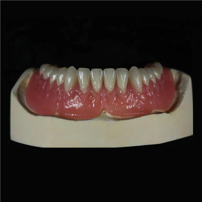 Denture Sħiħa Akriliku Rimovibbli